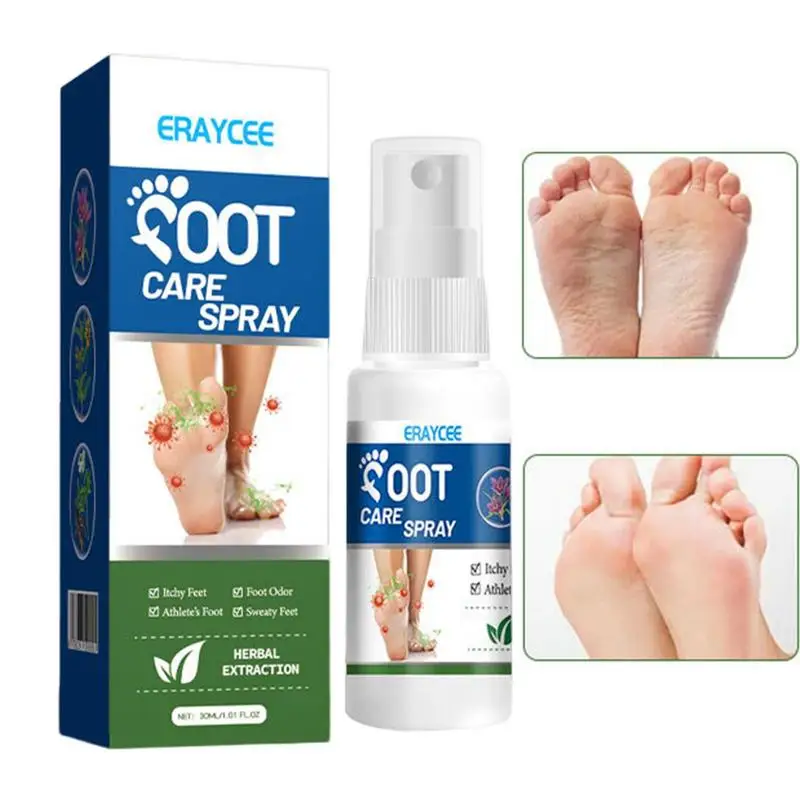 

Foot Deodorants Spray Freshener 30ml Natural Foot Liquid Spray Foot Spray Odor Eliminators For Feet And Shoes For Athletes
