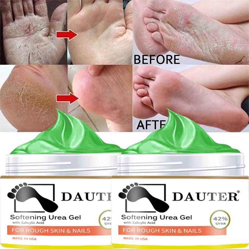 

Chinese Herbal Foot Cream Heel Scab Removal, Exfoliation, Dry Cracked Callus Repair and Exfoliation Hand and Foot Care