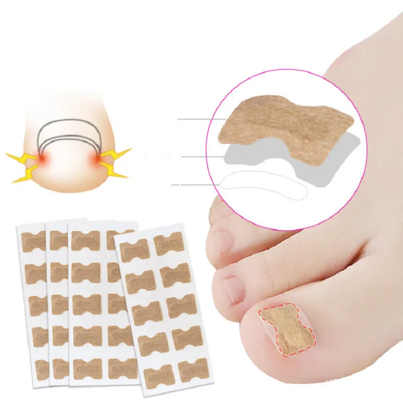 

10pcs Nail Correction Stickers Ingrown Toenail Corrector Patches Paronychia Treatment Recover Corrector Pedicure Tools