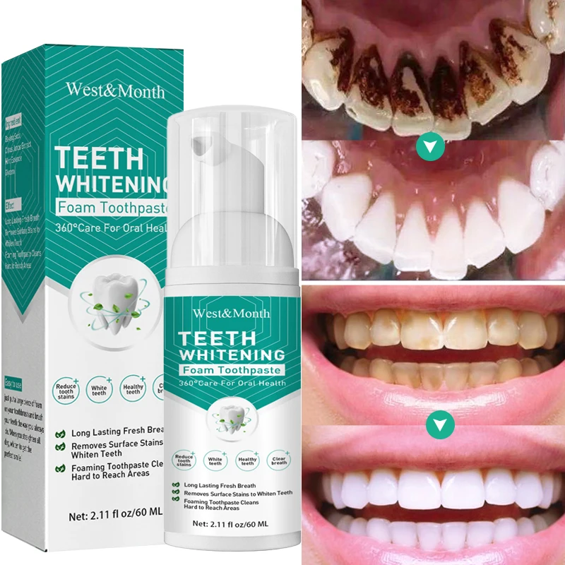 

Teeth Whitening Mousse Toothpaste Whiten Deep Cleaning Dentifrice Removes Plaque Stains Tooth Bleaching Oral Hygiene Product