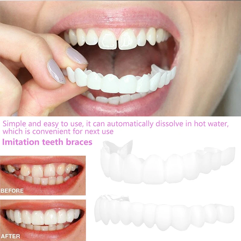 teeth whitening Teeth Braces Simulation Denture Dental veneers Silicone fake Perfect Smile braces False tooth 2Pcs/Set - купить по