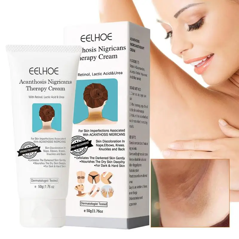 

Корректор темных пятен-крем для подмышек Acanthosis Nigricans терапевтическая масляная эссенция для подмышек, коленей, внутренней части бедра, интимная область