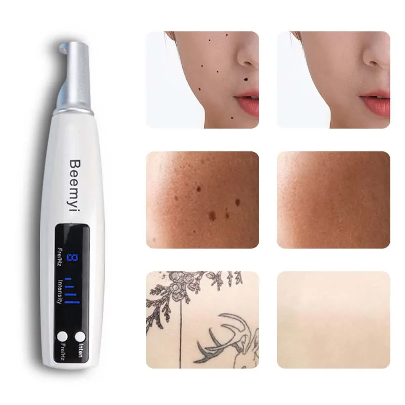 

Лазерная ручка для удаления татуировок, веснушек и пятен