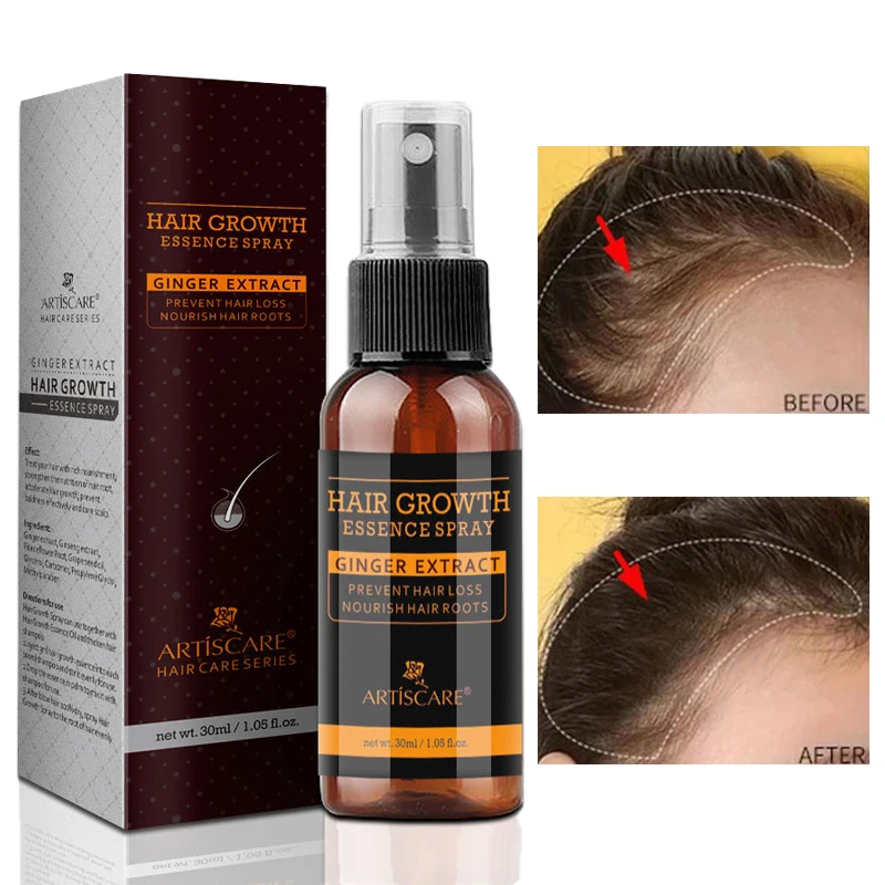 

Hair Growth Essence Spray Scalp Care Repair Nourishing Anti-Hair Loss Promotes Growth Strengthens Tenacity Hair Care 30ml