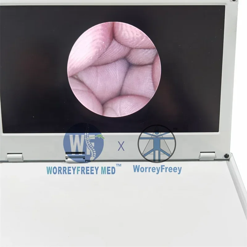 HD переносная эндоскоп-камера медицинский эндоскоп позвоночника Discectomy Interlaminar