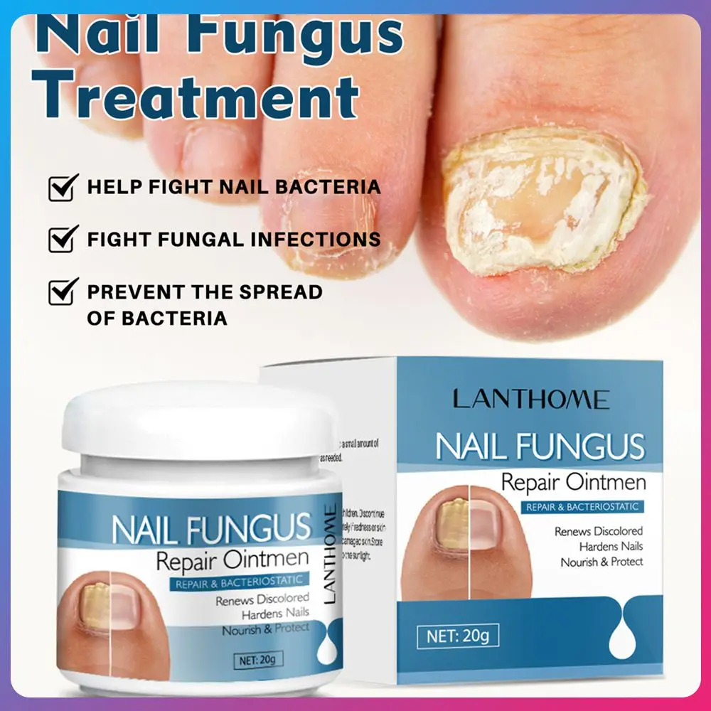 

Мазь для утолщенных ногтей, антибактериальная мазь для ногтей, искусственная паста для роста ногтей, личная гигиена, 20 г