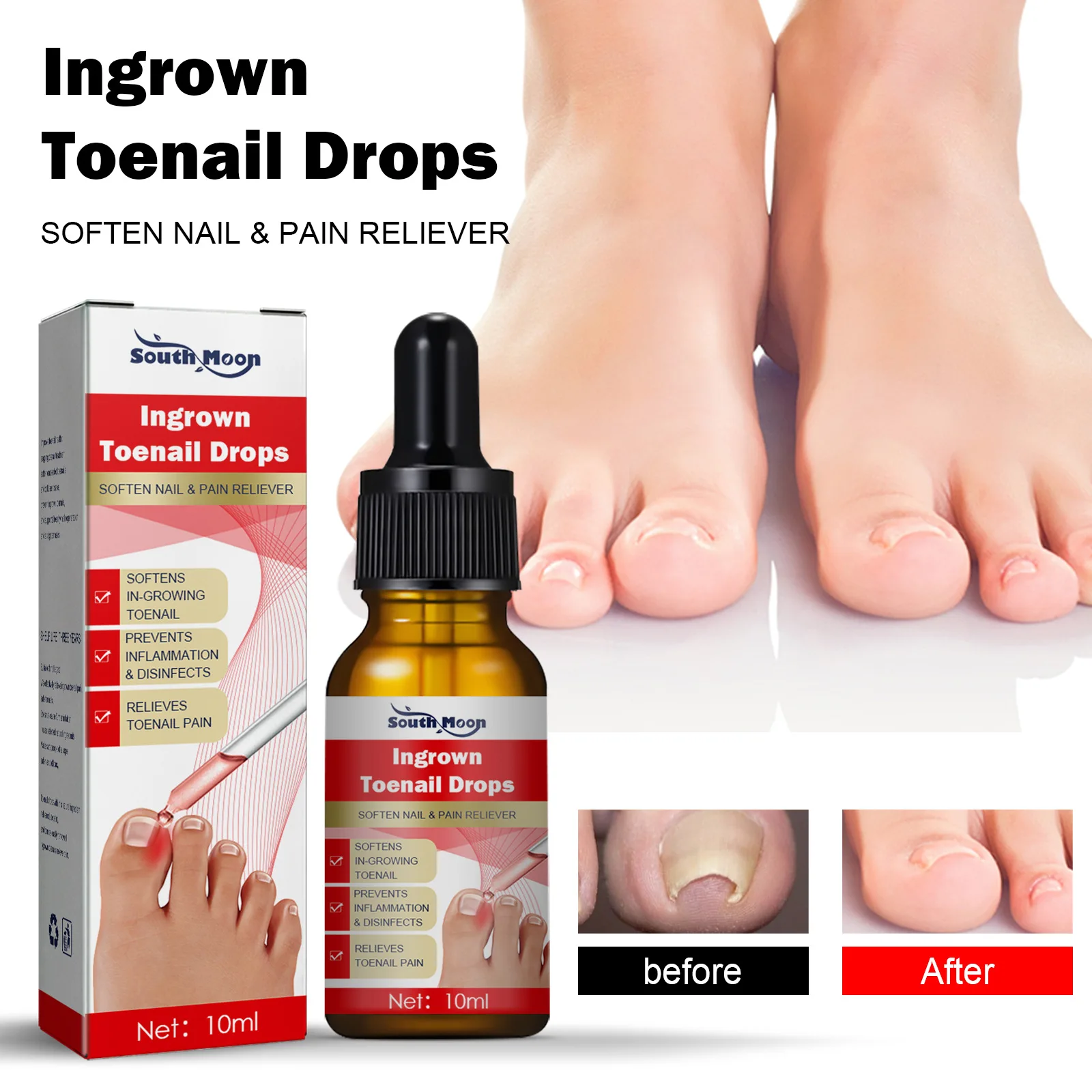 Endogenous nail repair essence nail repair nail care essential oil nail repair  toe nails fungal Prevent ingrown toenails