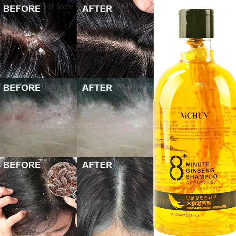 

Refreshing Shampoo for Oily Hair with Ginseng Extract Treat Dandruff and Itchy Scalp,Control Nourishing Long-Lasting Fragrance