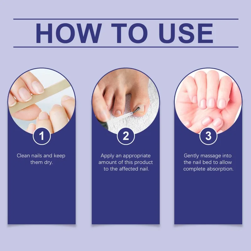 Ручка для ухода за ногтями нежный противогрибковый ремонт поврежденные руки