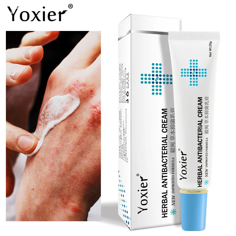 

Herbal Antibacterial Itching Cream Treatment Psoriasis Anti-itch Relief Eczema Skin Rash Urticaria Desquamation Ointment Care