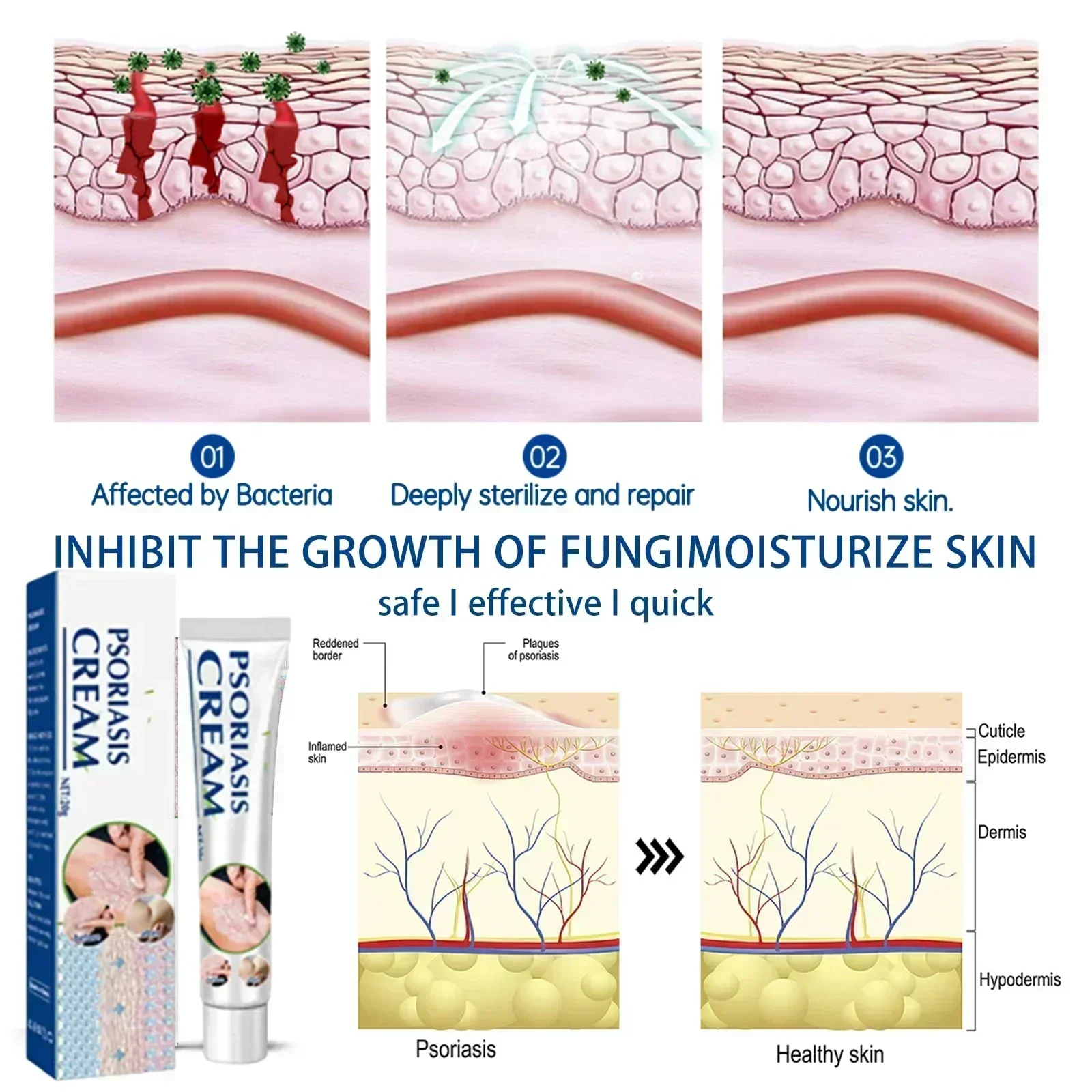 ГОРЯЧАЯ ПРОДАЖА антимикробное травяное лечение псориаза дерматит экзема мазь