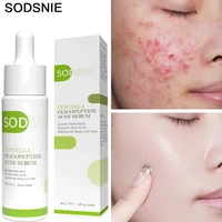 acne treatment serum centella pimple acne removal essence fade acne scar oil control moisturizing whiten brighten acne skin care