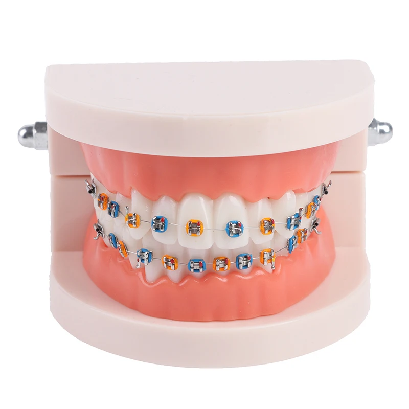 

Dental Orthodontic Teeth Model With Metal Braces School Teaching Equipment
