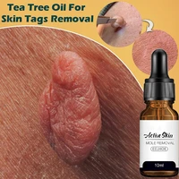 removing against moles remover anti verruca remedy essential oil treatment papillomas removal warts liquid skin tags 10ml