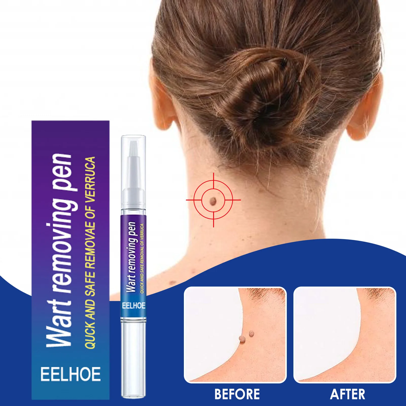 

Removing Against Moles Liquid Pen Treatment Painless Face Care Products Removal Of Warts Liquid Pen Skin Tags Remover Liquid