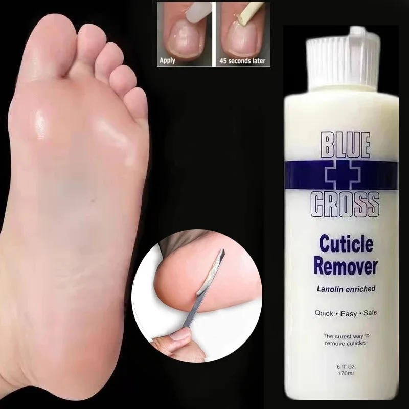 

Exfoliation Treatment Fluid Blue Cross Foot Softener Removing Dead Skin and Anti Cracking Corners Foot Scraper Pedicure Kit