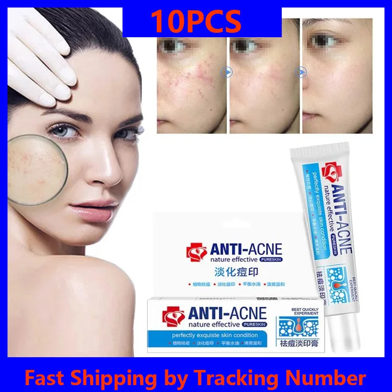 

Herbal Anti Effective Acne Removal Cream Traditional Chinese Medicine Treatment Shrink Pores Spots Gel Whitening Moisturizing