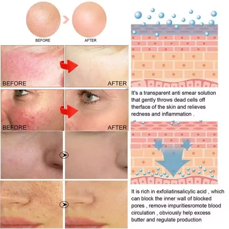 Provitamin B5 успокаивающий гель против покраснений восстанавливающий барьер для лица