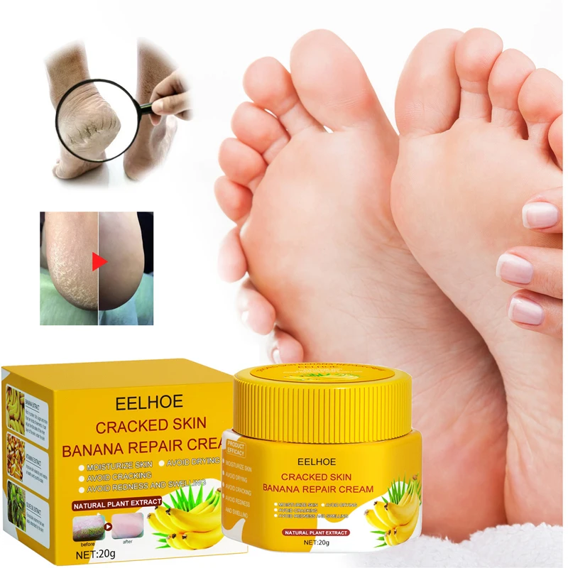 Heel Cracked Repair Banana Oil Anti Infection Removal Dead Skin Moisturizing Smooth Hand Feet Care