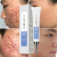 effective acne removal face cream treatment acne scar repair products oil control anti acne smooth skin moisturizing beauty care