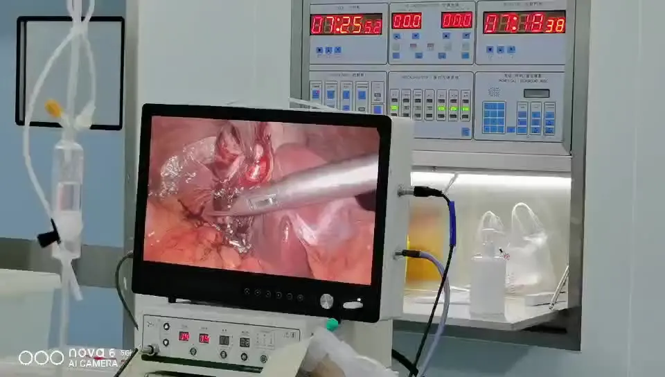 

Endoscope camera portable endoscopy camera Imaging system compatible with both rigid and flexible endoscopes