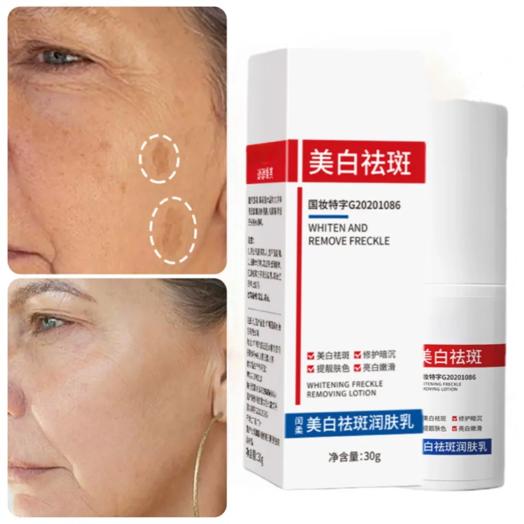

30ml Niacinamide Whitening Spot Cream Fades Freckle Dark Spots Face Cream Improve Dullness Brighten Moisturize Skin Care Product