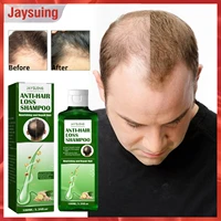 jaysuing ginger shampoo hair growth dense anti hair loss deep cleaning oil control anti itching scalp repair shampoo hair care