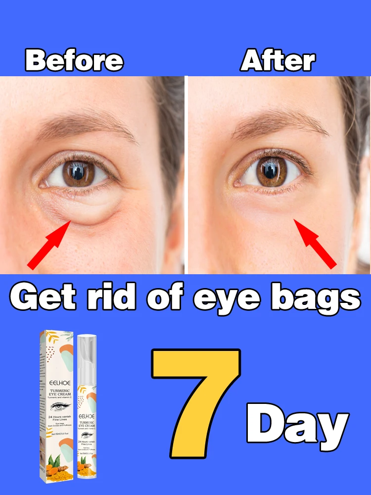 

Anti-wrinkle Eye Cream Effectively Eliminate Dark Circles Eye Bags Fine Lines Around Eyes Crow's Feet Anti-wrinkle Eye Cream