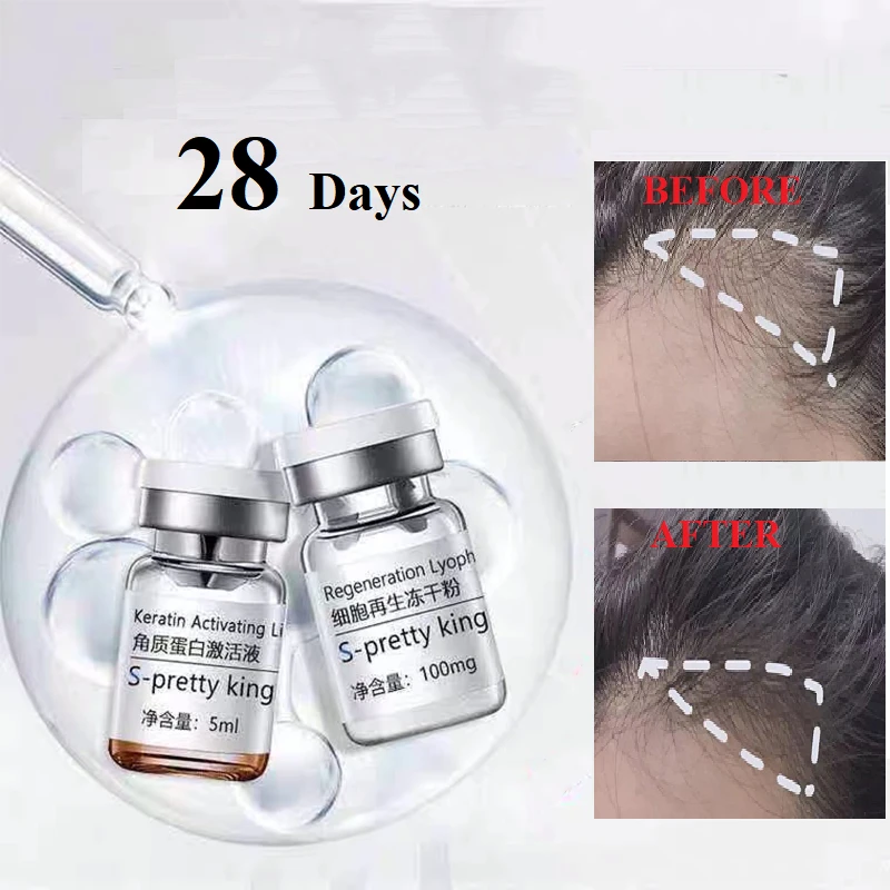 

Stem Cell Hair Growth Serum Anti Hair Loss 28 Days Fast Grow Prevent Thinning 2pcs/Set Hair Care Essence