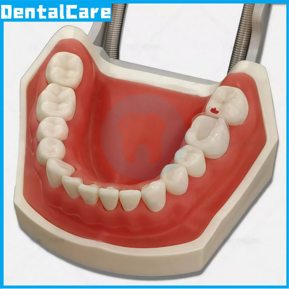 Фото Стоматологические матрицы Bioclear Clear Matrix Posterior, прозрачные, для моляров, композитные, класса B, 4.5/5.5/6.5/8.0, 0.038 мм №2