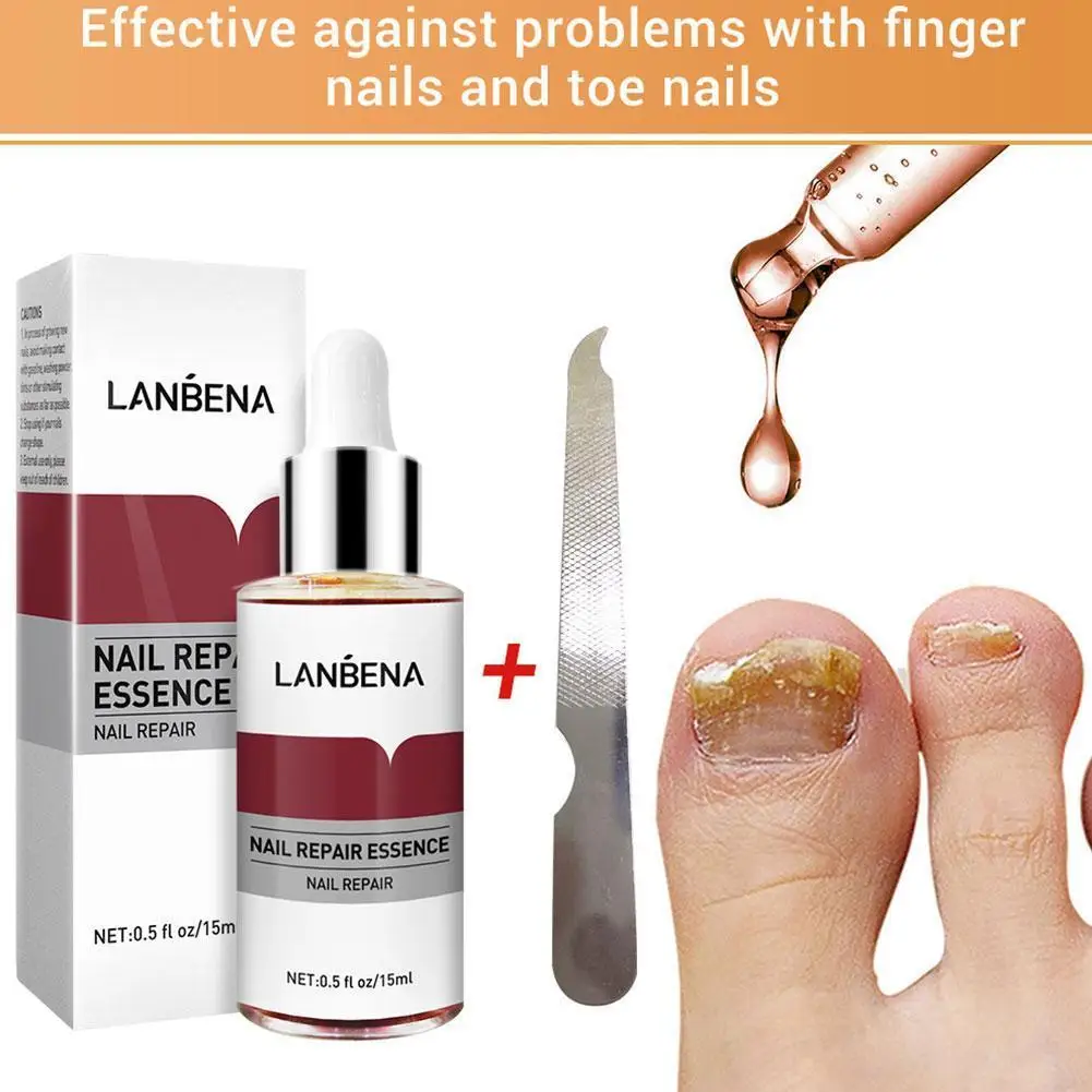 

LANBENA Nail Fungus Treatment Essence Serum Hand Care Foot Fungal Removal Repair Gel Anti-infective Paronychia Onychomycosis