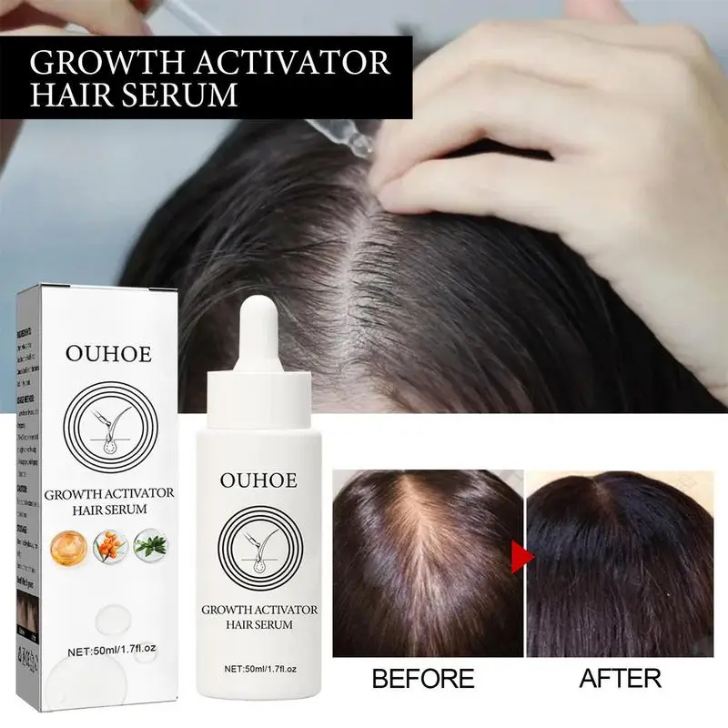 

Hair Growth Oil For Hair Loss For Women 50ml Hair Growth Oil Supports Visibly Stronger Thicker Hair Fast-Absorbing Hair Care