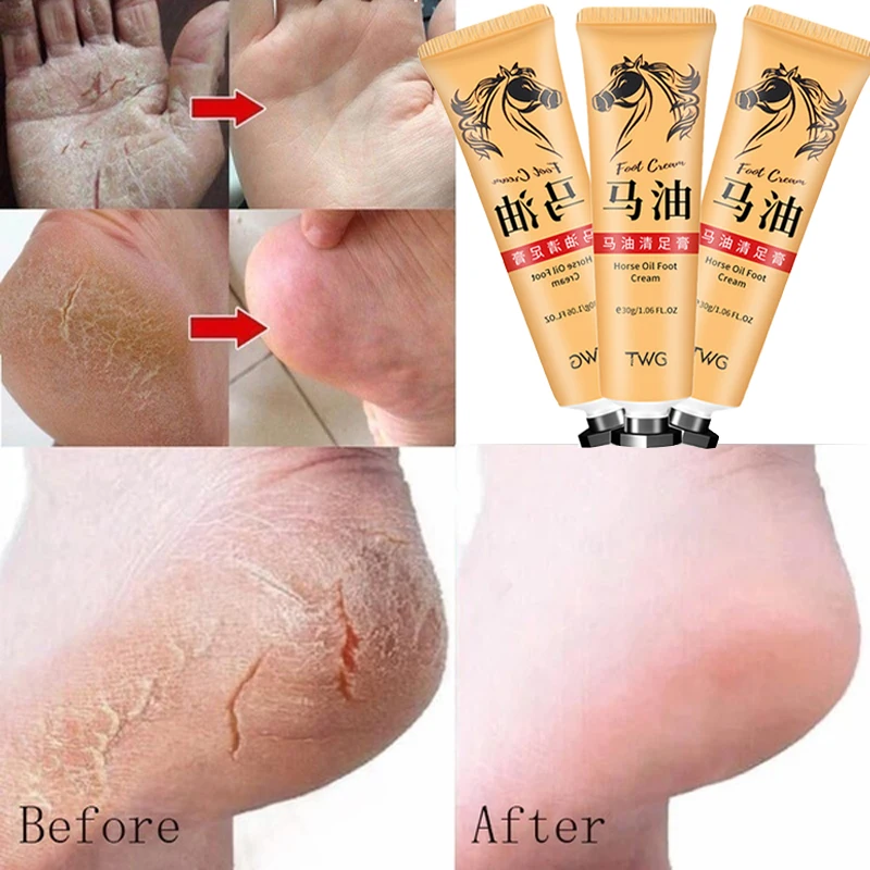 

30g Horse Oil Anti-Drying Crack Foot Cream Heel Cracked Repair Cream Removal Dead Skin Long Lasting Moisturizing Hand Feet Care