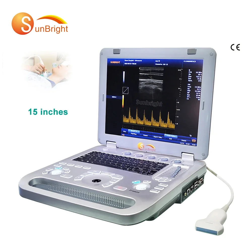 SUN-800F2 Medical ecografo портативный профессиональный акушерский ноутбук ультразвуковой