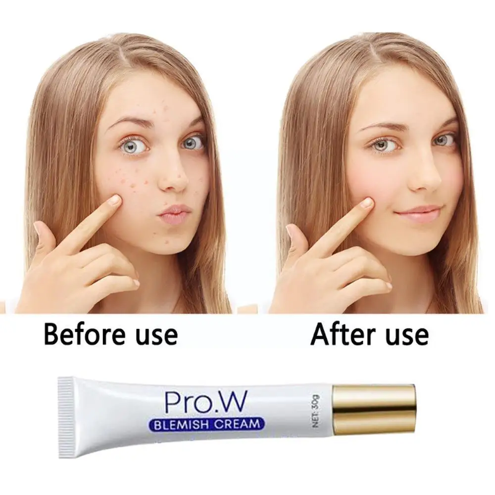 

Травяной крем для удаления акне, 30 г, лечение акне, увлажняющий крем для кожи, отбеливание пор, контроль пятен, устранение морщин, автомобиль...