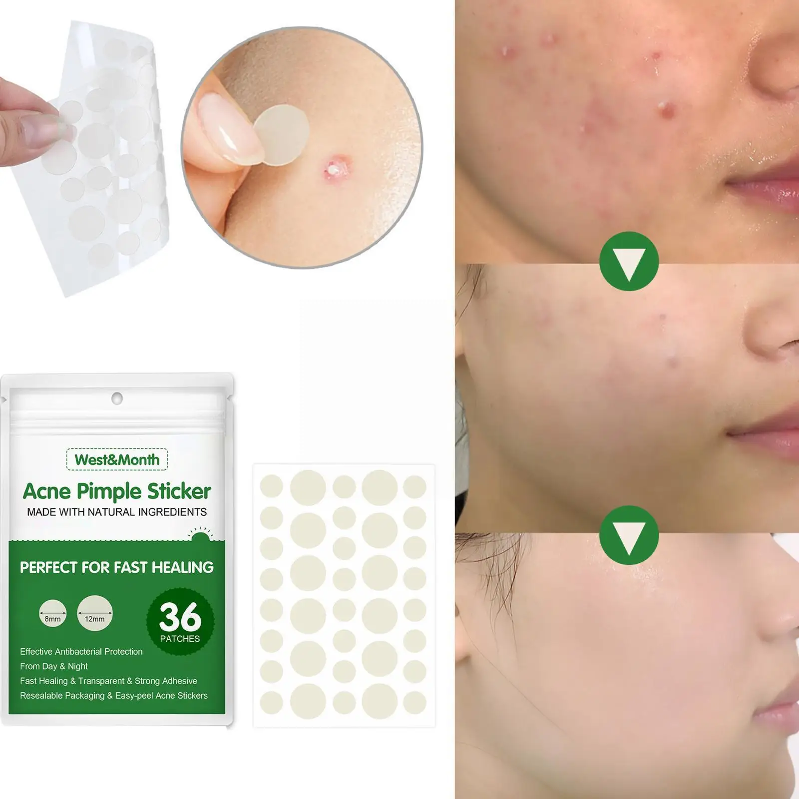 

36 Patches Waterproof Acne Pimple Patch Stickers Acne Breathable Pimple Acne Tool Care Patch Treatment Invisible Skin Remov L3g2
