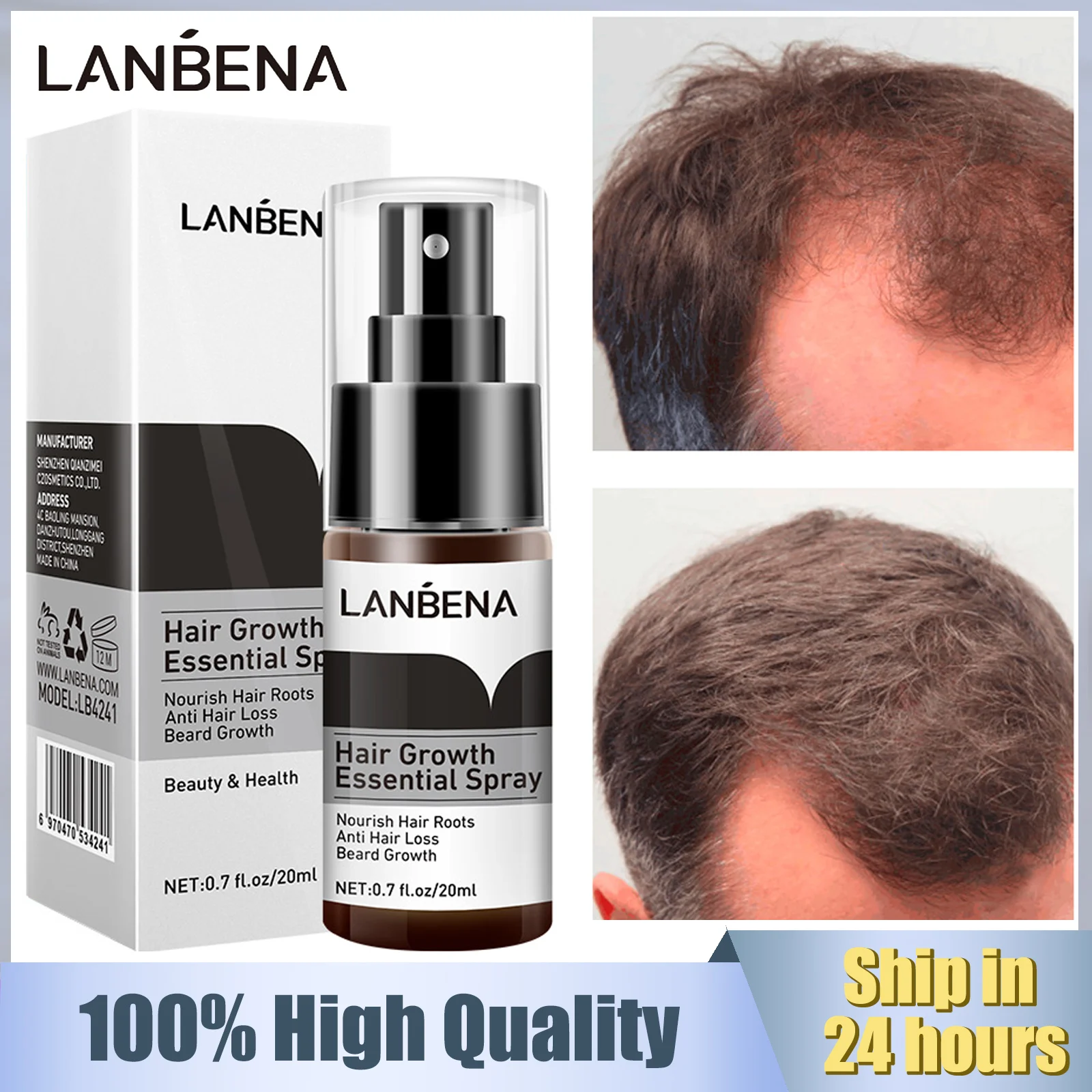 

LANBENA Fast Hair Growth Essence Spray Preventing Baldness Consolidating Man Anti Hair Loss Nourish Roots Hair Repair Growing