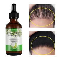 1pc rosemary hair growth essential oil anti hair loss natural hair growth serum reduce frizz dryness scalp nourishment hair care