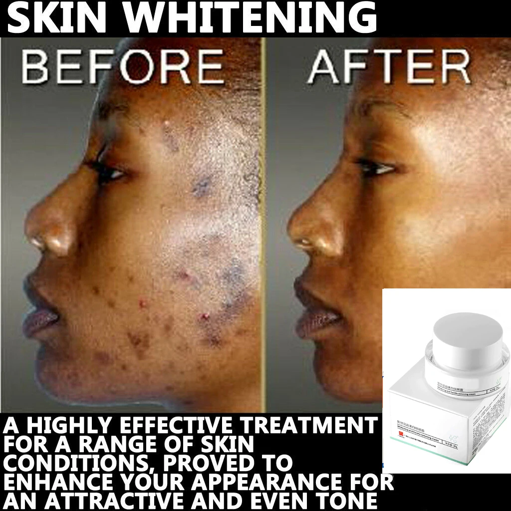 

30g Original Gluta C with Kojic Acid Plus Glutathione Lightening Face Arm Neck Cream SPF 30 free shipping