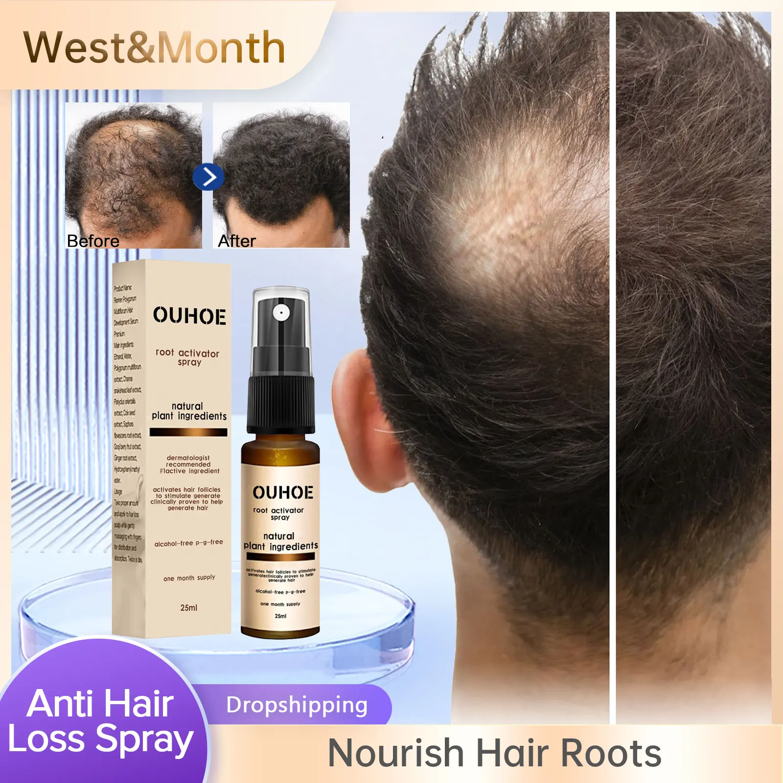 

Спрей для роста волос для мужчин, средство для ухода за кожей головы, глубокое увлажнение, защита от выпадения волос, быстрое восстановление и восстановление сухих поврежденных корней, спрей-активатор