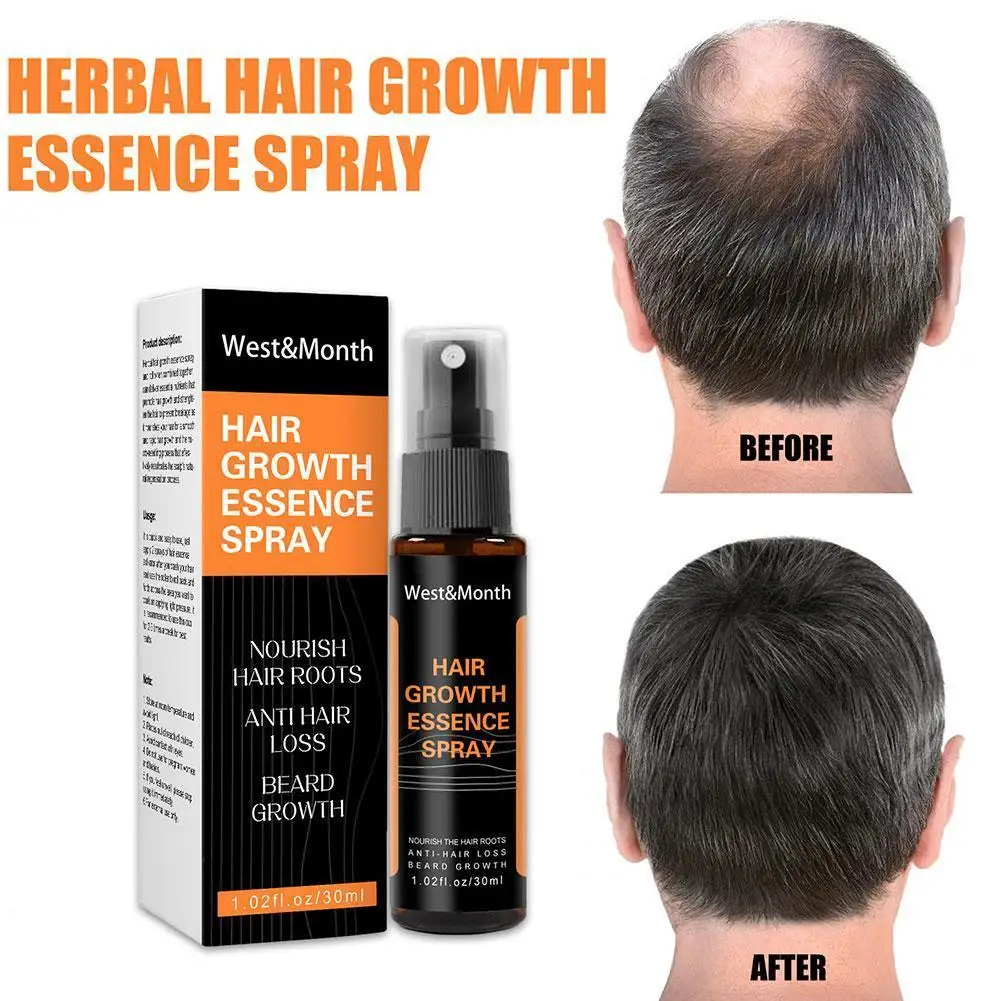 

Hair Growth Spray Natural Ginger Essence Spray Anti Hair Loss Baldness Nourish Root Hair Care Treatment Effective Fast Growth