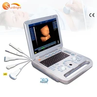 15 inch led cardiac ultrasound echocardiography 3d 4d laptop ultrasound machine