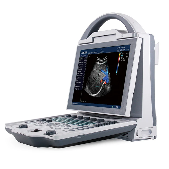 

Заводская цена DCU12 полный цифровой цветной допплер ультразвуковой сканер для ветеринарии