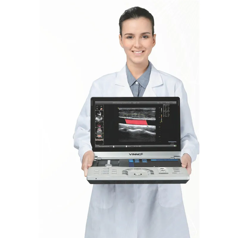 Медицинские ультразвуковые инструменты VINNO 6 портативный цветной допплер 4D