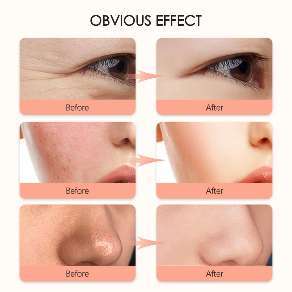 НОВАЯ косметическая маска с зарядкой через USB 7-цветная светодиодная фотонная