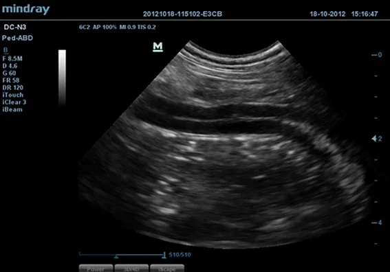Рисунок 5 - Система ультразвуковой визуализации