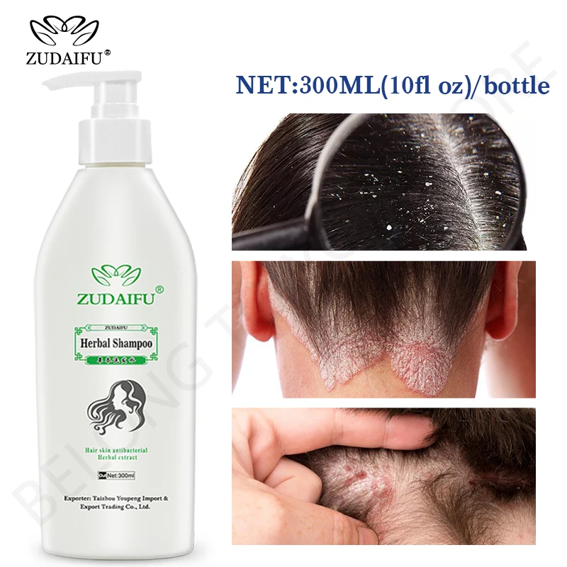 

300ml New!Zudaifu Hair Psoriasis Seborrheic Skin Care Treatment Dermatitis Eczema Herbal Shampoo Repair Scalp, Remove Dandruff