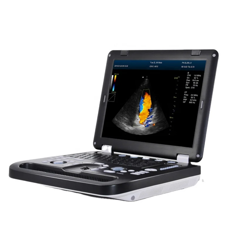 

Powerful Image 15 inch LED 4D Portable Color Ultrasound Doppler Machine with Warranty CW with two probes built-in Li-battery