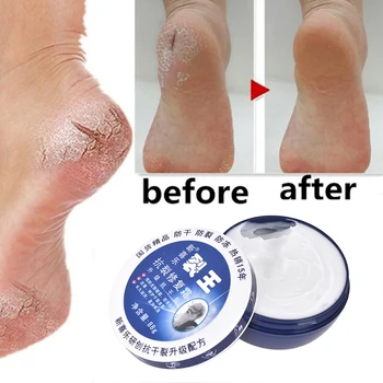 Anti Crack Foot Cream Chapped Oil Anti-Drying Crack Feet Cream Heel Cracked Repair Cream Removal Bad Skin Hand Feet Care Mask 1