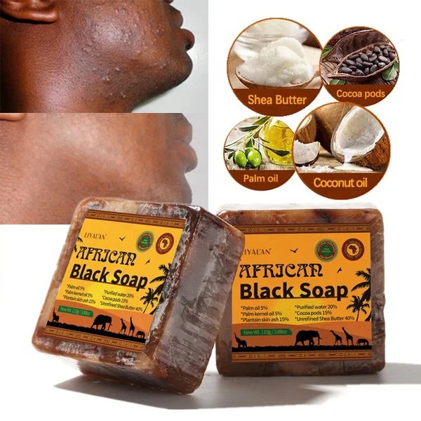 

110g African Black Soap Natural Bath Body Treatment Acne Skin Care Magic Anti Rebelles Beauty Moisturizing Shea Butter